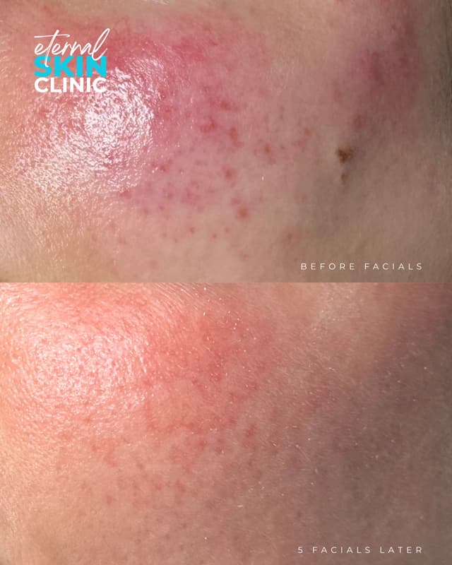 Ultimate Custom Facial