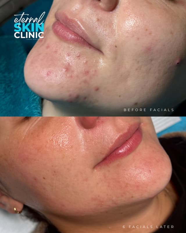 Ultimate Custom Facial