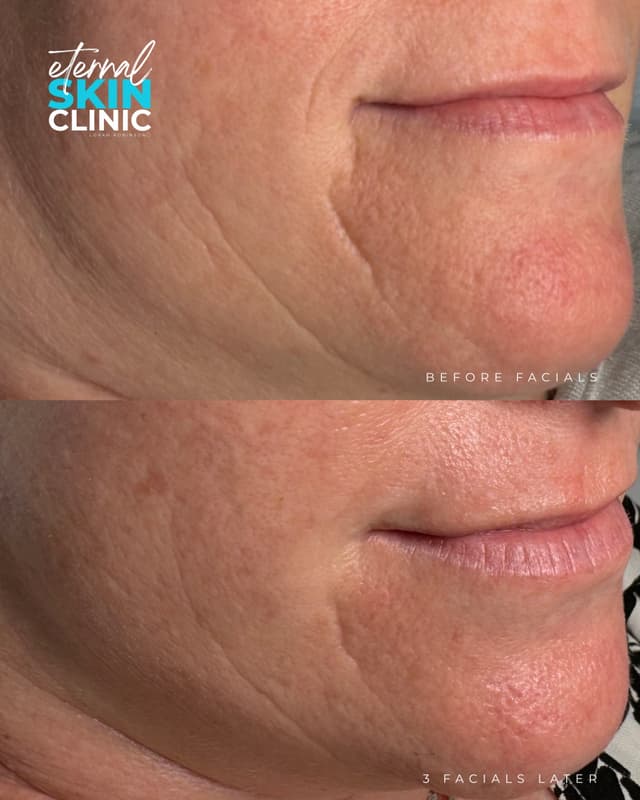 Ultimate Custom Facial