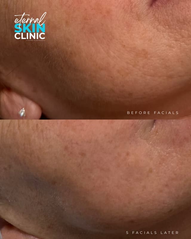 Ultimate Custom Facial