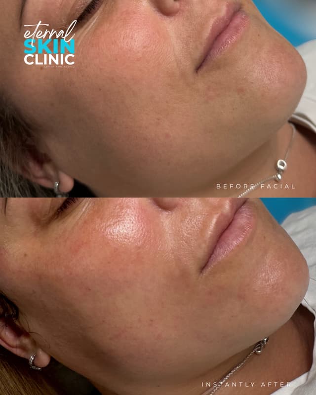 Ultimate Custom Facial