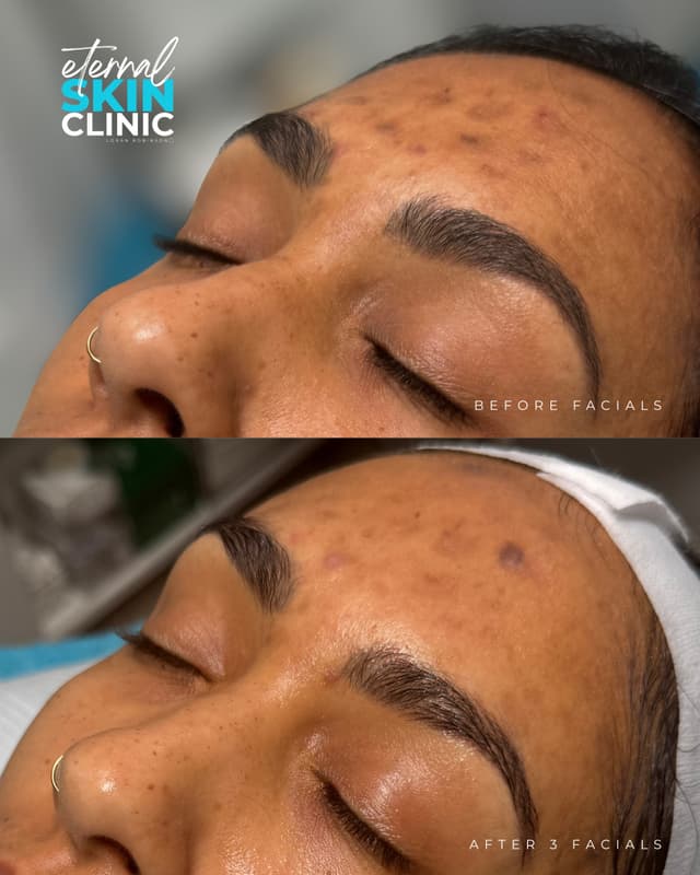 Ultimate Custom Facial