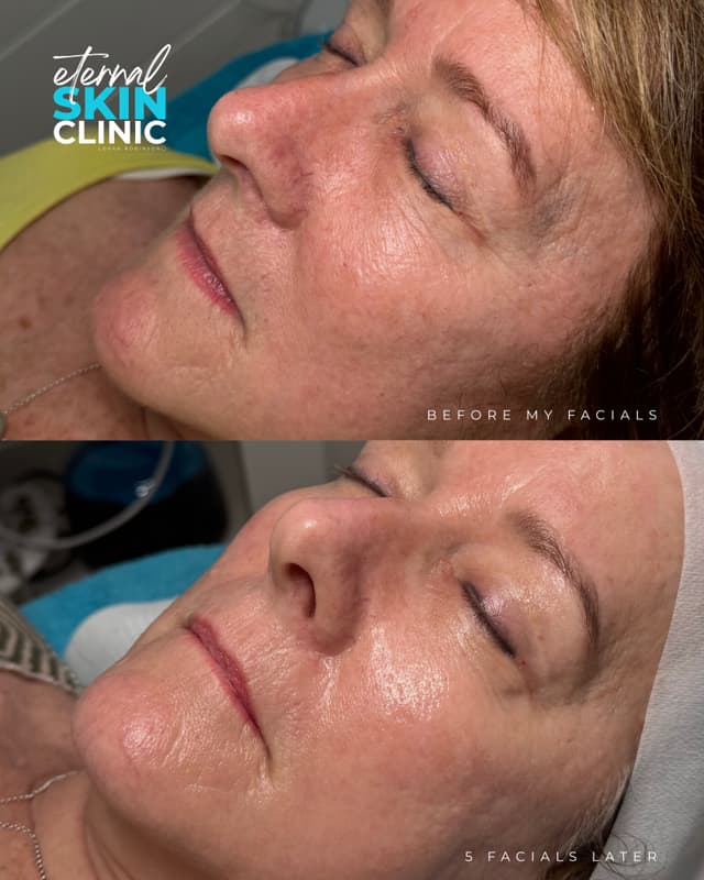 Ultimate Custom Facial