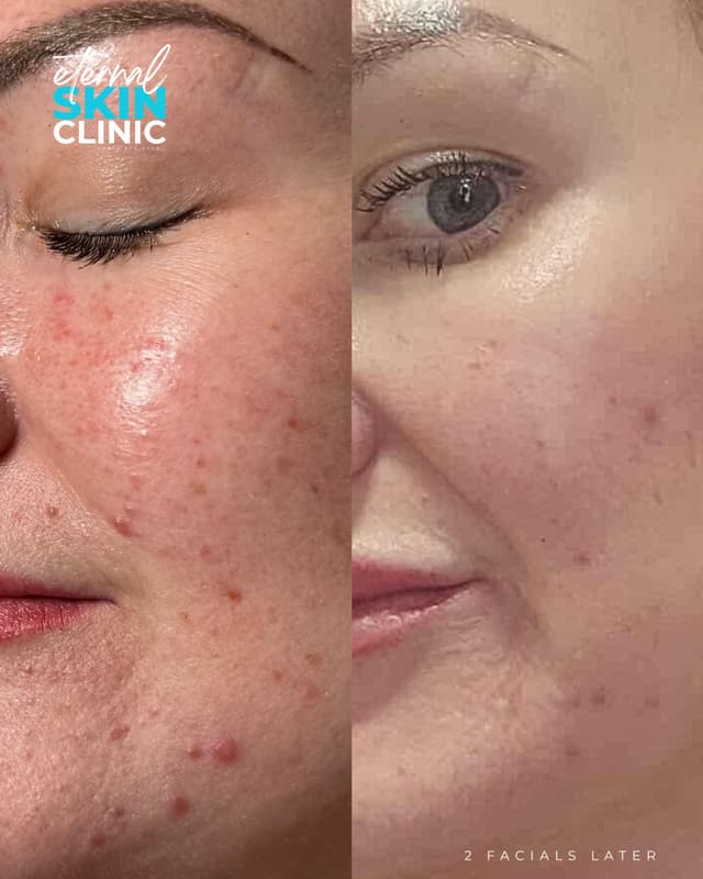 Ultimate Custom Facial