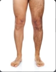 Leg waxing