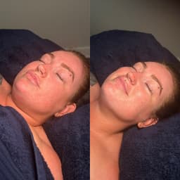 Drain & Sculpt Facial