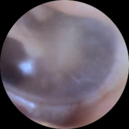 After I've finished extraction clear ears a picture of health