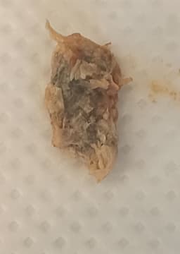 Extreamly large plug removal