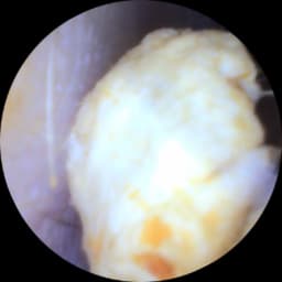 We find all sorts in ears ....please don't use cotton buds !!!