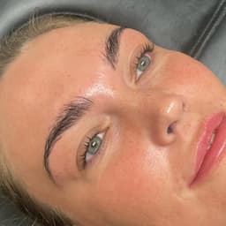 Million Dollar Facial x š«§