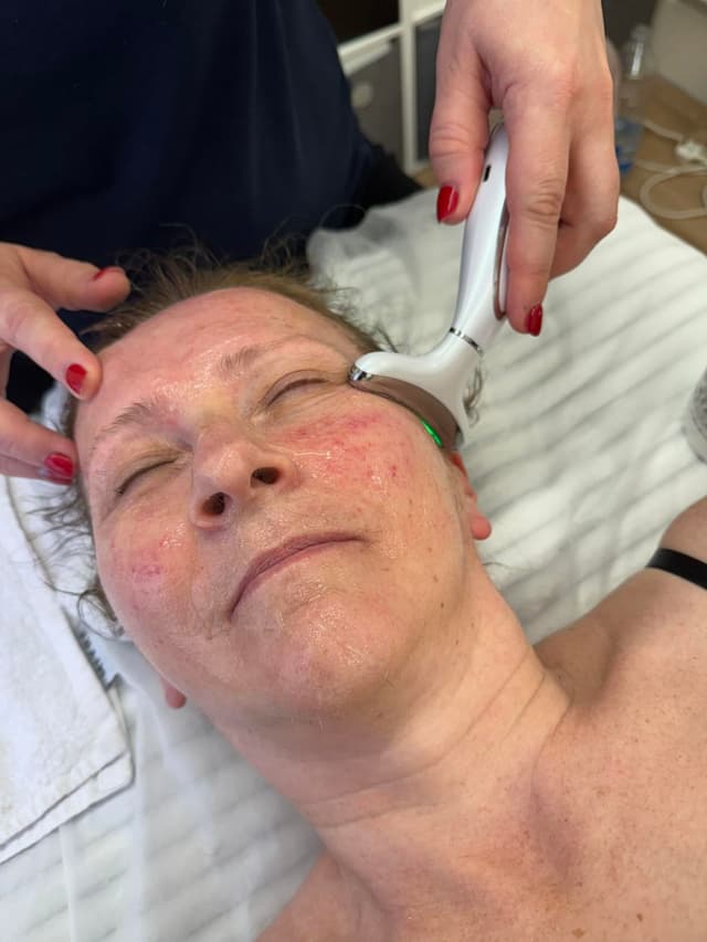 Facial