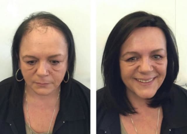 MicroLine Hair Topper