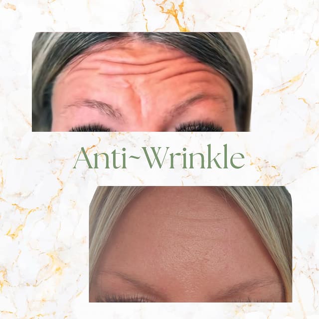 Anti-wrinkle