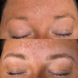 Microblading