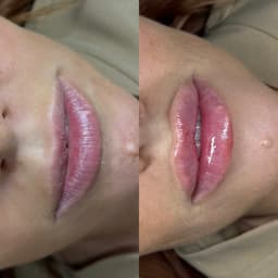 B E F O R E  &  A F T E R