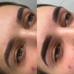 Hybrid Brow before & after