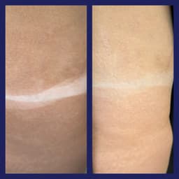 8% solution, before and after showering