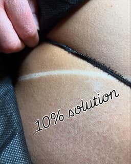 10% solution