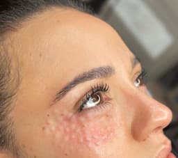 Under eye polynucleotide