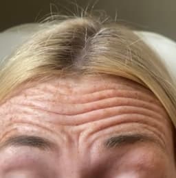 Anti wrinkle before