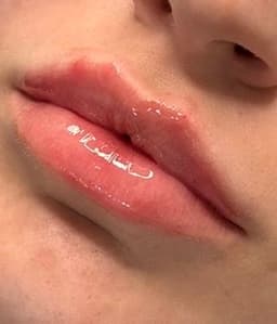 Cupids bow