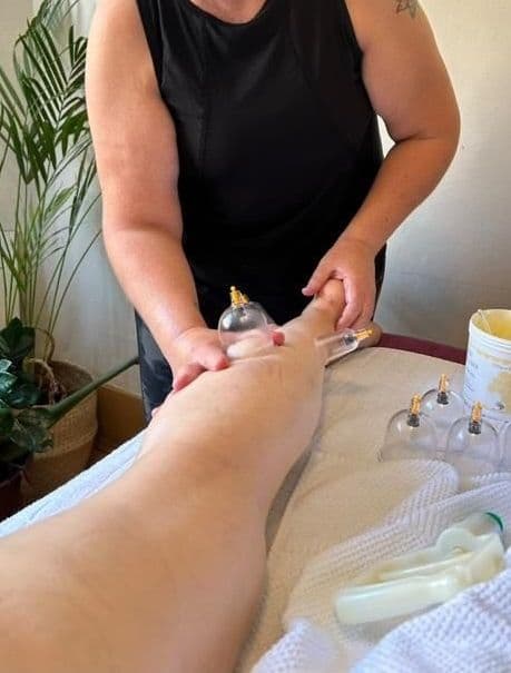 Cupping therapy