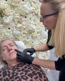 Anti Wrinkle Treatments in Windsor