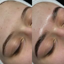 Brow Lamination