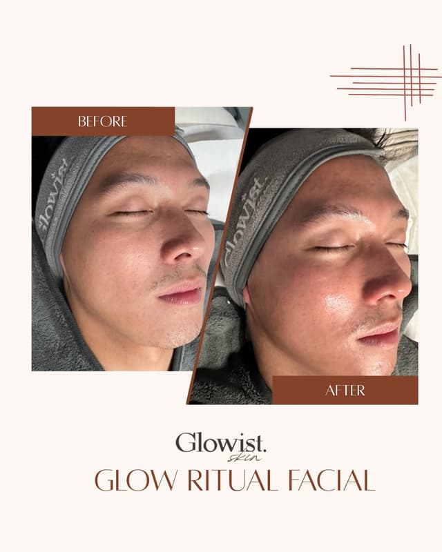Glow Facial Ritual - Our bestselling facial and all time favourite!