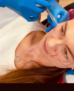 Professional dermal filler treatment in Stevenage at Serene Aesthetics – nurse-led care designed to enhance natural contours and deliver safe, subtle results.