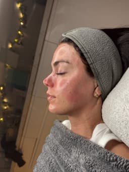 Glass Skin Facial 🤤