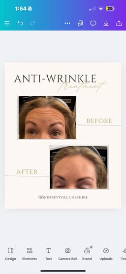 Anti-wrinkle