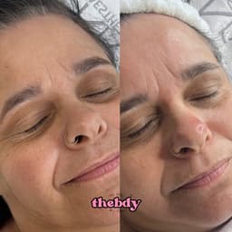 1 x customised facial