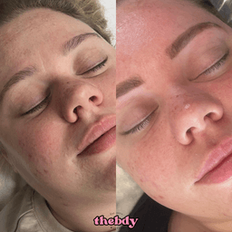 Customised facial