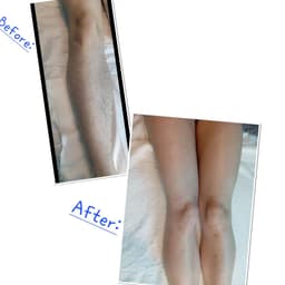 LEGS WAX BEFORE & AFTER